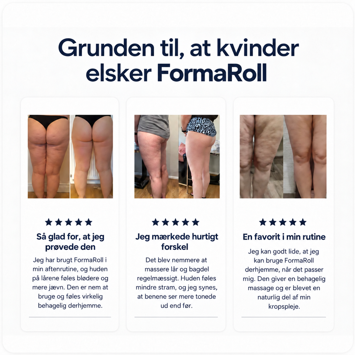 FormaRoll™ – Elektrisk Massage- og Celluliterulle